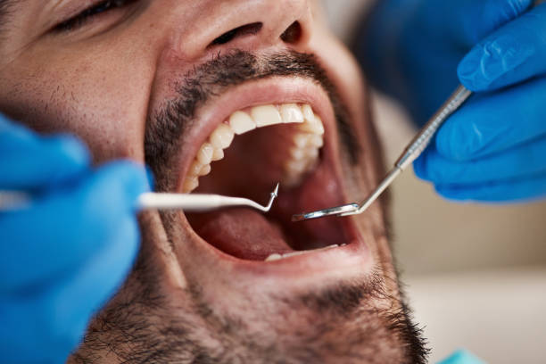 Best Same-Day Emergency Dentist in Putney, GA